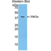 Western blot analysis of the recombinant protein.