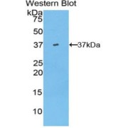 Western blot analysis of the recombinant protein.