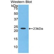 Western blot analysis of recombinant Human Hornerin (HRNR).