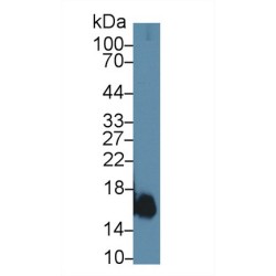 Myoglobin (MB) Antibody