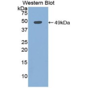 Western blot analysis of recombinant Human Myoglobin Protein.