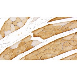 Myoglobin (MB) Antibody