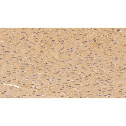 Myoglobin (MB) Antibody