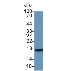 Myoglobin (MB) Antibody