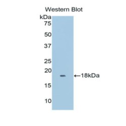 Myoglobin (MB) Antibody