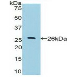 Nucleolin (NCL) Antibody