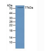 Western blot analysis of Human Serum.