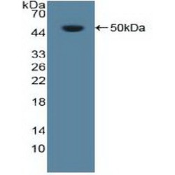 Nucleolin (NCL) Antibody