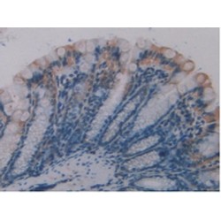 Occludin (OCLN) Antibody