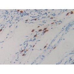 Resistin (RETN) Antibody