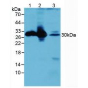 Western blot analysis of (1) Mouse Brain Tissue, (2) Mouse Kidney Tissue and (3) Mouse Eye Tissue.