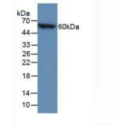 Calbindin (CALB) Antibody