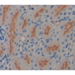 Calbindin (CALB) Antibody