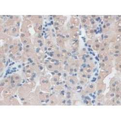 Ezrin (EZR) Antibody