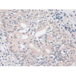 Ezrin (EZR) Antibody