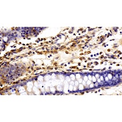 Fibronectin (FN1) Antibody
