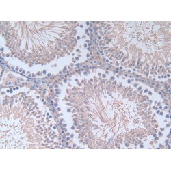 Fibronectin (FN1) Antibody