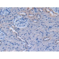 Fibronectin (FN1) Antibody