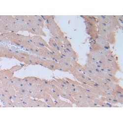 Fibronectin (FN1) Antibody