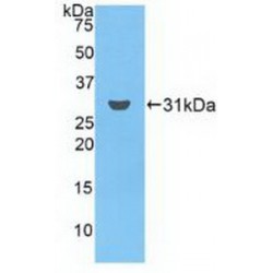 Ficolin 3 (FCN3) Antibody