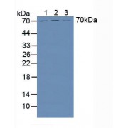 Western blot analysis of (1) Human HeLa cells, (2) Human HepG2 Cells and (3) Human Liver Tissue.