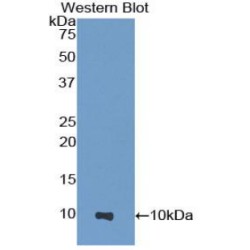 Heparanase (HPSE) Antibody