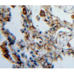 Heparanase (HPA) Antibody