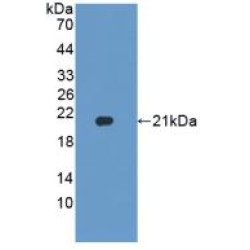 Heparanase (HPSE) Antibody