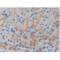 Heparanase (HPSE) Antibody