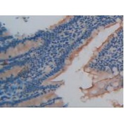 Heparanase (HPSE) Antibody