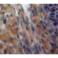 Inhibin Alpha Chain (INHA) Antibody