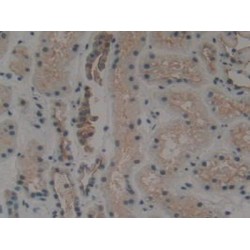 Keratin 1 (KRT1) Antibody