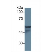 Western blot analysis of Human A431 cell lysate, using Rat KRT4 Antibody (1 µg/ml) and HRP-conjugated Goat Anti-Rabbit antibody (<a href="https://www.abbexa.com/index.php?route=product/search&amp;search=abx400043" target="_blank">abx400043</a>, 0.2 µg/ml).