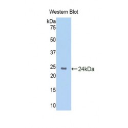 Keratin 4 (KRT4) Antibody