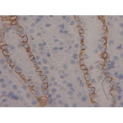 Keratin 4 (KRT4) Antibody