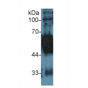 Western blot analysis of Rat Tongue lysate, using Human KRT5 Antibody (1 µg/ml) and HRP-conjugated Goat Anti-Rabbit antibody (<a href="https://www.abbexa.com/index.php?route=product/search&amp;search=abx400043" target="_blank">abx400043</a>, 0.2 µg/ml).