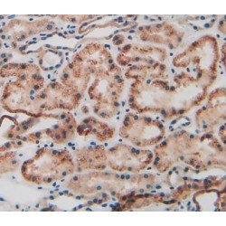 Keratin 9 (KRT9) Antibody