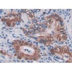 Myostatin (MSTN) Antibody