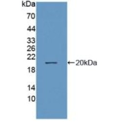 Neprilysin / NEP (MME) Antibody