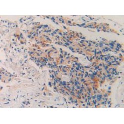 Neprilysin / NEP (MME) Antibody