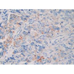 Neprilysin / NEP (MME) Antibody