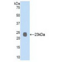 Neprilysin / NEP (MME) Antibody