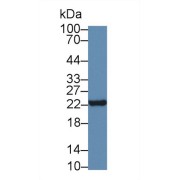 Western blot analysis of Mouse Small intestine lysate, using Human NT Antibody (5 µg/ml) and HRP-conjugated Goat Anti-Rabbit antibody (<a href="https://www.abbexa.com/index.php?route=product/search&amp;search=abx400043" target="_blank">abx400043</a>, 0.2 µg/ml).