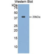 Western blot analysis of the recombinant protein.