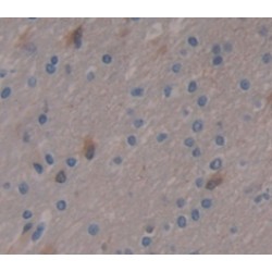 Periplakin (PPL) Antibody