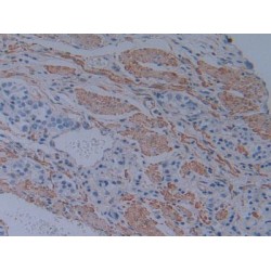 Plastin 3 (PLS3) Antibody