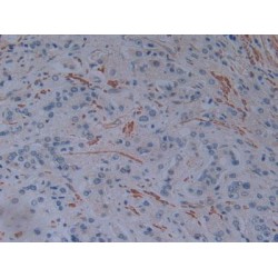 Plastin 3 (PLS3) Antibody