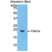abx100397