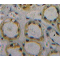 CD59 Glycoprotein (CD59) Antibody