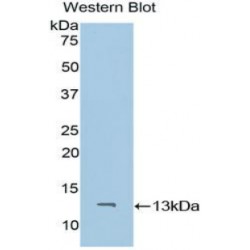 CD59 Glycoprotein (CD59) Antibody